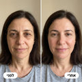 Korenet PDRN — תמונה 3